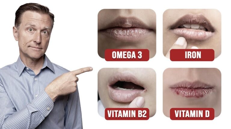 Unmasking the Connection: Vitamin Deficiency and Dry Lips